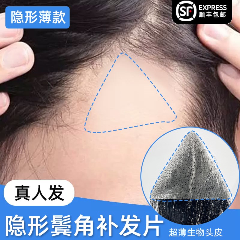 发际线鬓角假发贴男士前额补发隐形m型一片N式真发贴刘海额角假发