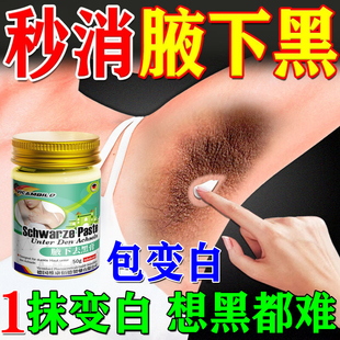 腋下美白去黑棘皮腋窝除黑色素沉淀去除脖子大腿内侧胳膊肘黑神器