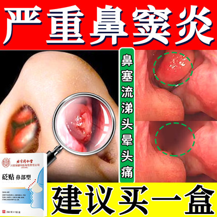 鼻窦炎专用药根治疗通气鼻贴儿童的鼻涕倒流有痰排脓中药膏喷剂MQ