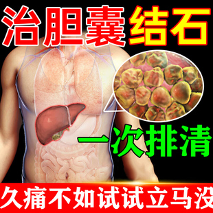 胆囊结石特效药治疗息肉胆囊炎碎石专用的药中药苗昶堂胆囊贴HM
