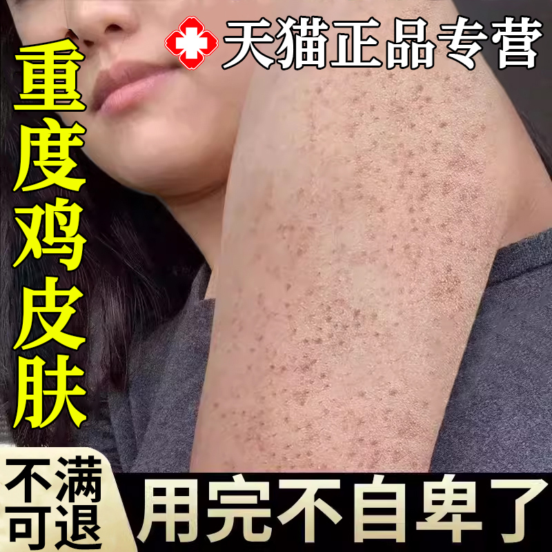 鸡皮肤疙瘩毛囊角化症专用膏药贴膏HM手臂毛囊炎胳膊上长疙瘩