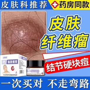 肿硬块皮肤纤维瘤去除药膏皮下硬疙瘩皮下脂肪瘤消瘤膏官方正品UU