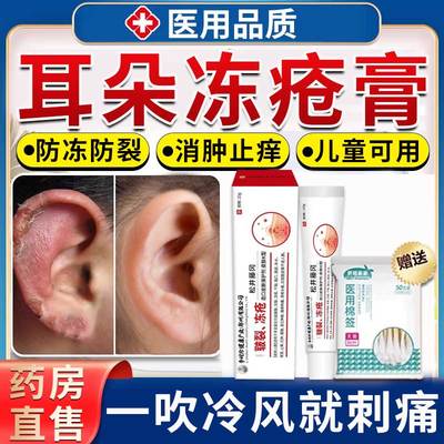 耳朵冻疮膏防冻防裂儿童可用