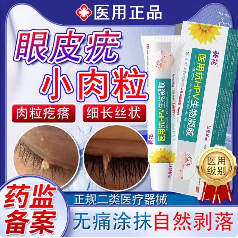 眼皮疣眼皮上长肉球小肉粒丝状疣去除专扁平疣药育用面颈部医用LL