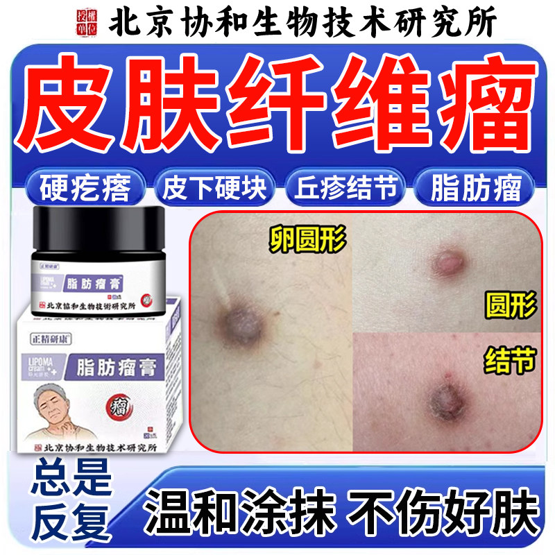皮肤纤维瘤膏肿块去除皮下脂肪瘤消瘤硬块搭膏药贴皮下粉瘤疙瘩JY