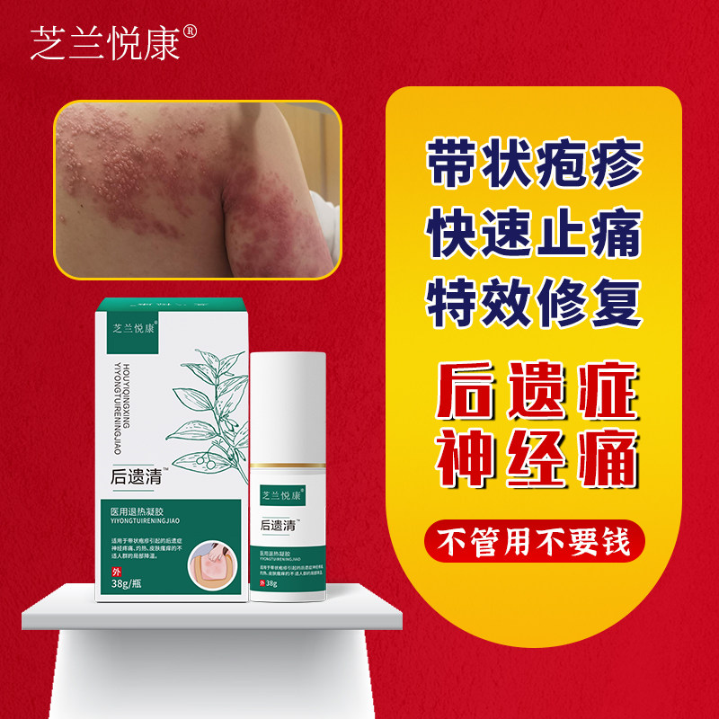 芝兰悦康带状疱疹后遗症神经痛后遗清型医用退热凝胶