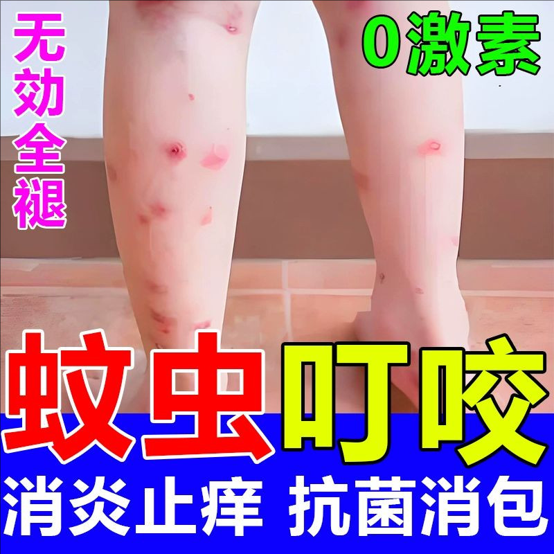 健佰信蚊虫叮咬快速止痒消肿药膏婴儿宝宝成人臭虫跳蚤蚊子去黑印图片