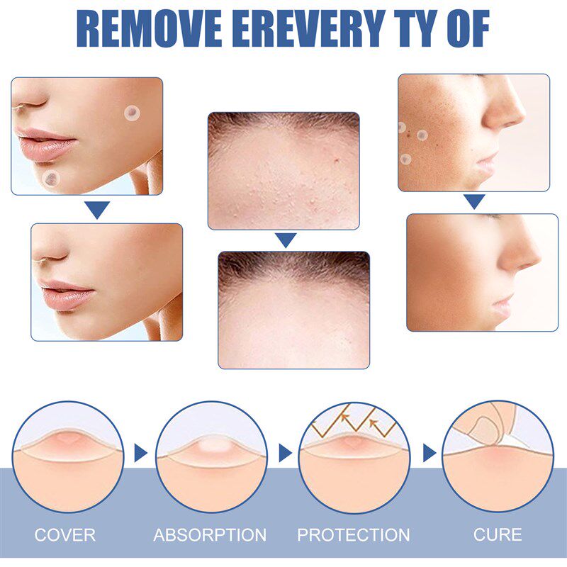 新品144Pcs Sgkin Tag Remover Patches Mole Wart Removing Stic