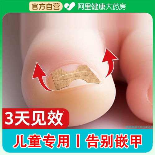 【皮肤科推荐】儿童专用甲沟矫正