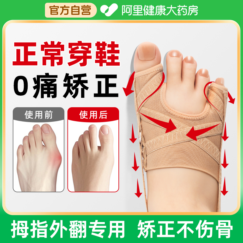 大药房甄选】正常穿鞋无痛矫正