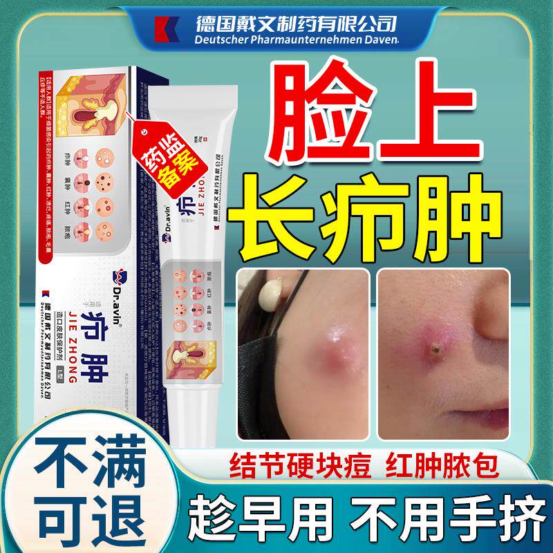 脸上红肿硬块痘贴疙瘩结节