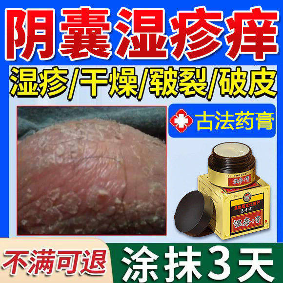 阴囊湿疹瘙痒男性潮止癣特
