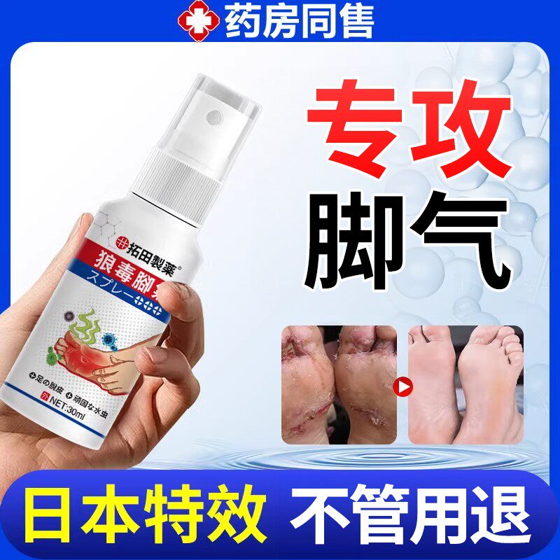 狼毒脚喷雾剂止特痒脱烂皮