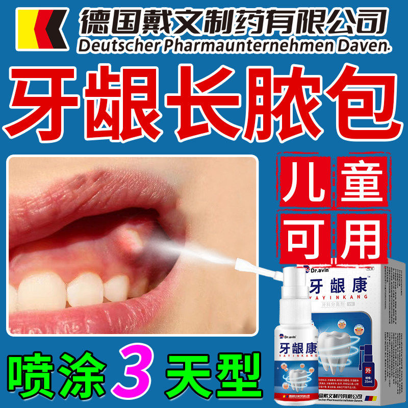 儿童牙龈长脓包喷剂肿痛齿