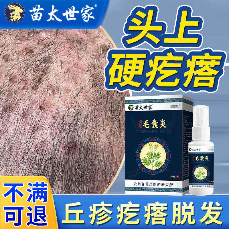 头皮毛囊炎药监备案部专用