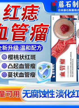血管瘤痣搭普萘洛尔软膏去