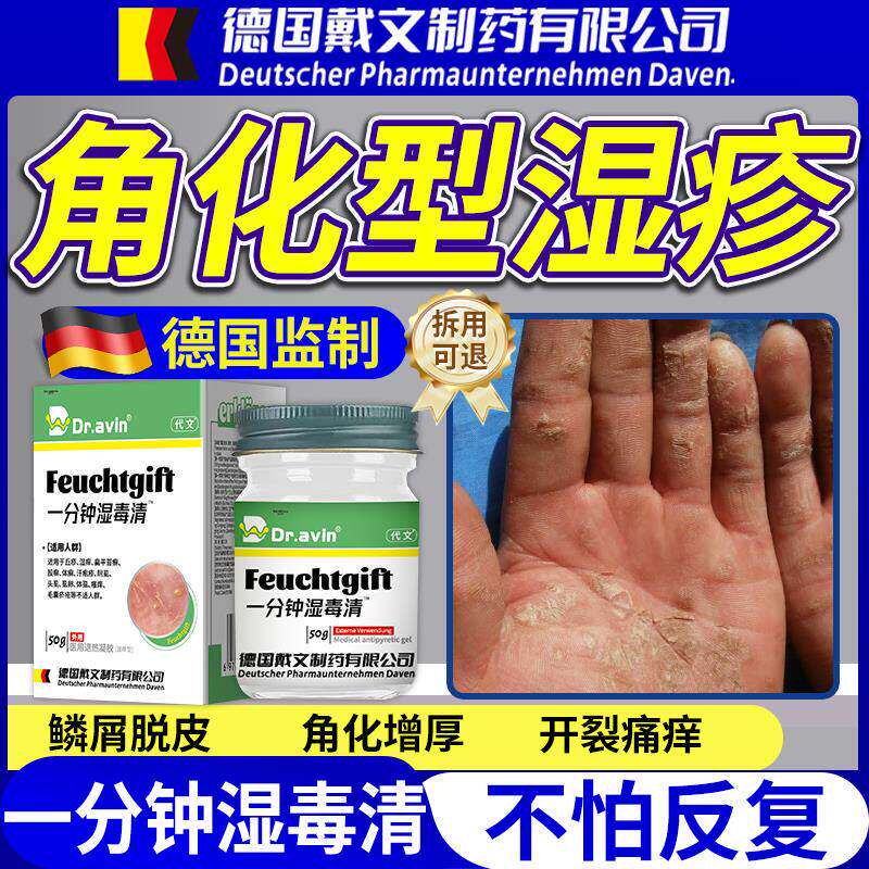 手部角化型湿疹专用指癣膏