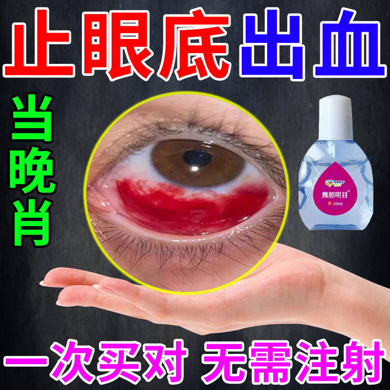 眼底出血眼水结膜充血眼睛淤血红血丝视物模糊眼里有异物感黄斑