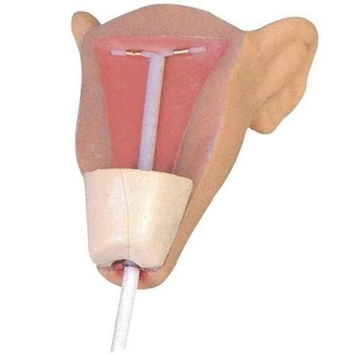 中为医疗 F9E 高级宫内避孕器训练模型