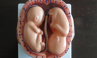 8件 妊娠胚胎模型 怀孕胎儿模型 胎儿妊娠发育过程模型