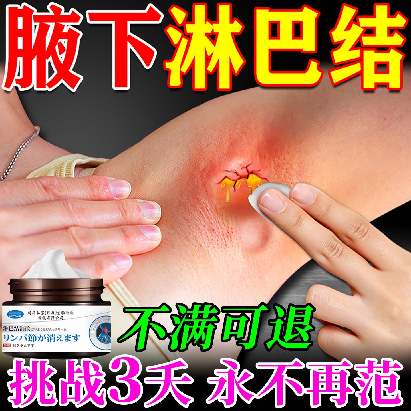 淋巴结消散膏腋下淋巴副乳脖子淋巴耳后淋巴结节肿大膏神器去副乳
