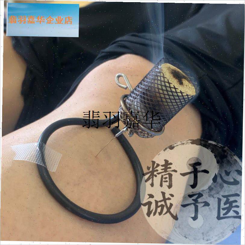 温针灸防落灰器温针灸无烟艾灸器温针灸针灸器温针X灸防烫工具艾,
