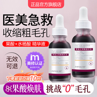 果酸水杨酸精华液毛孔细致收缩刷去闭口粉刺