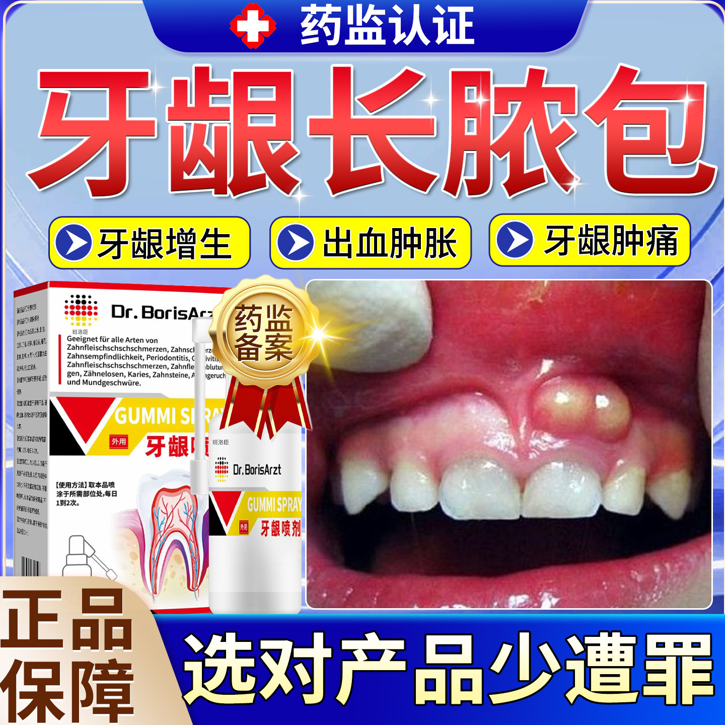 牙龈脓包肿包牙根发炎上火牙肉肿痛消炎增生牙周炎增生息肉出血u9