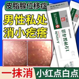 皮脂腺异位症阴茎阴囊包皮皮脂腺异位生殖器增生毛囊炎小疙瘩丘疹