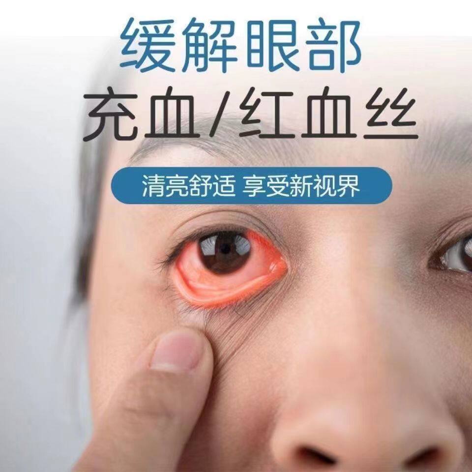 极速眼睛红血丝修复去除眼睛清澈去黄F消除干涩模糊眼贴缓解眼疲