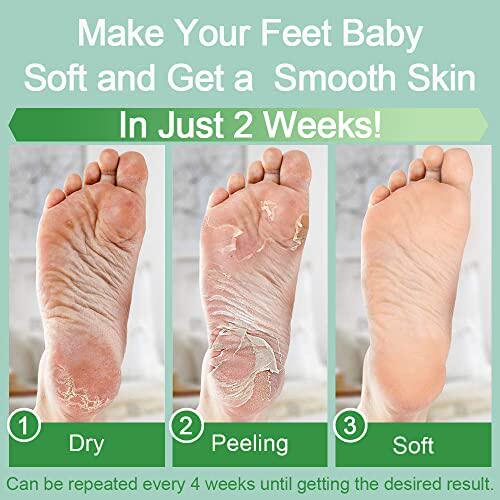极速Foot Peegl Mask 2 Pack  Exfoliating Foot Masks  Baby Foo