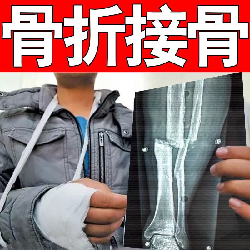 极速粟氏 跌打损伤贴膏脚扭伤x修复外敷草yao手腕拉伤崴脚骨裂骨