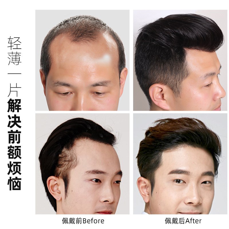 假发贴发际线男士前额补发片假刘海真发全手织隐形前额补发块