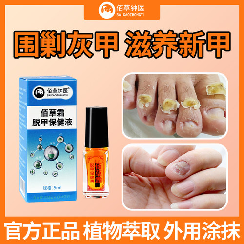 灰指甲增甲厚脱甲膏-无用退全款