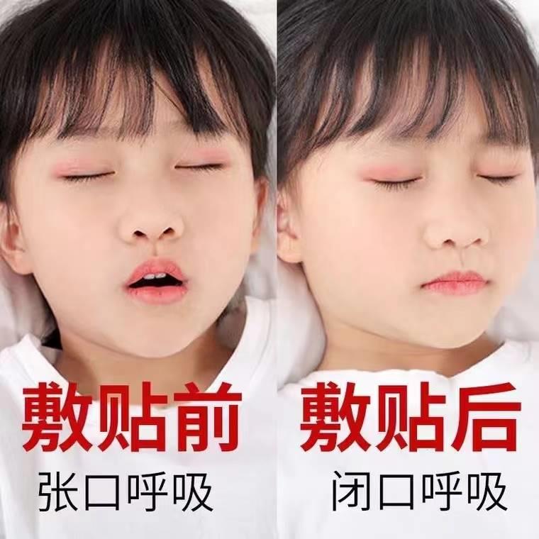 极速腺样体肥大睡觉打呼噜张口呼吸面容矫正器儿童鼻X子不通气嘴