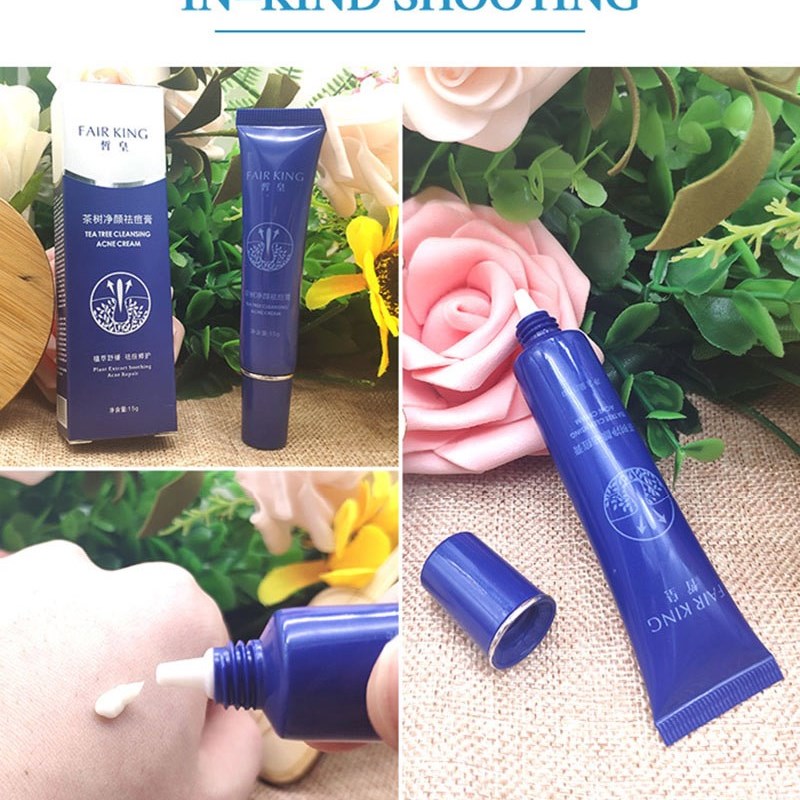 极速Acne Treatment Blackhead Removal AntiL Acne Cream Oil Co