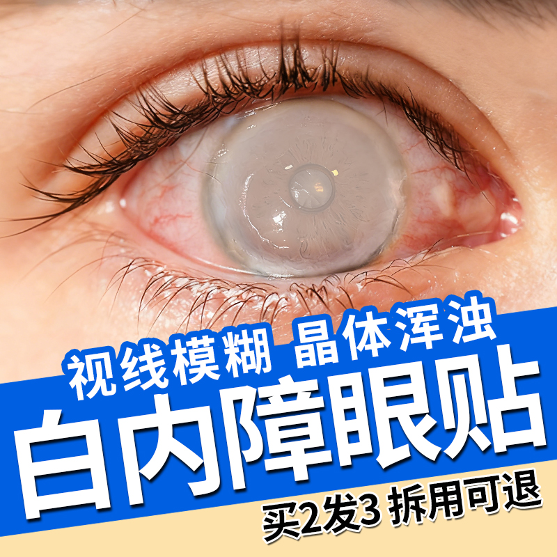白内障护眼贴非治疗中老年人眼睛视力模糊晶状体浑浊畏光看不清用