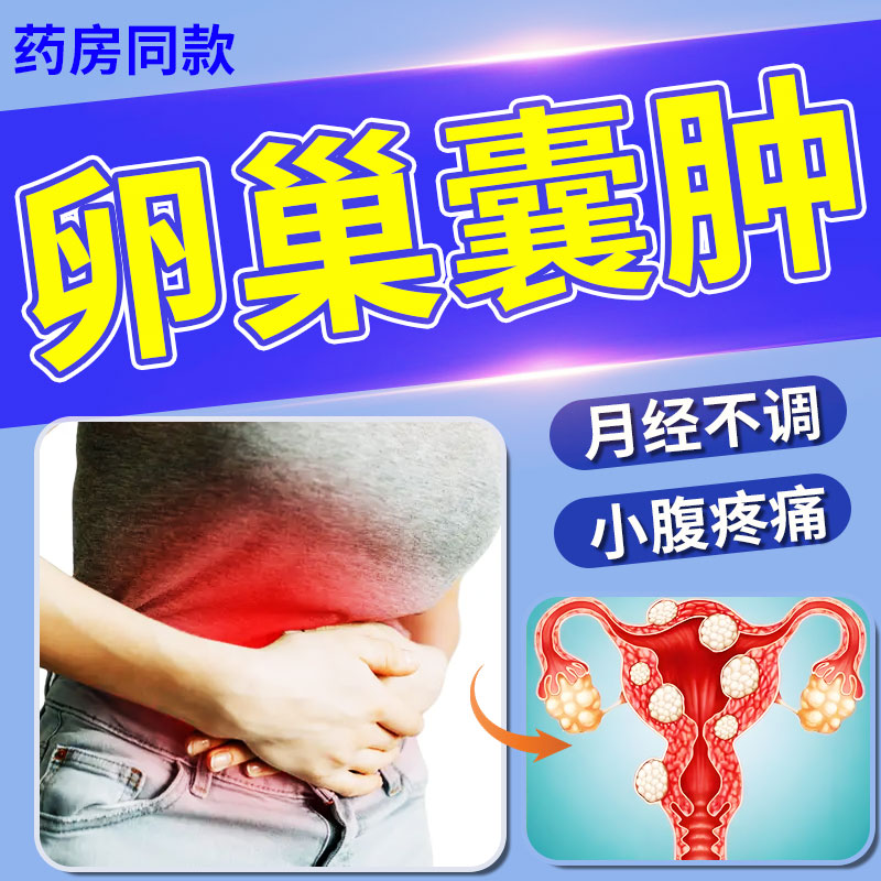 子宫肌瘤中药贴非消除卵巢巧克力囊肿非治疗腺肌症专用的宫寒痛经