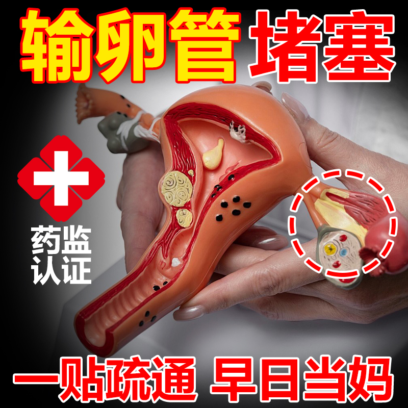 治疗输卵管堵塞疏通的