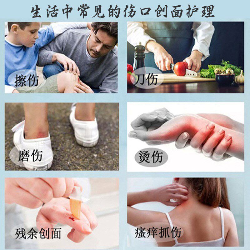 正品康瑞保 医用人表皮喷雾剂 因子皮肤擦伤微小创口生长创面护理