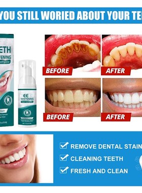 极速Teeth Whitening Mousse Dental Care Essence RemovXe Plaqu
