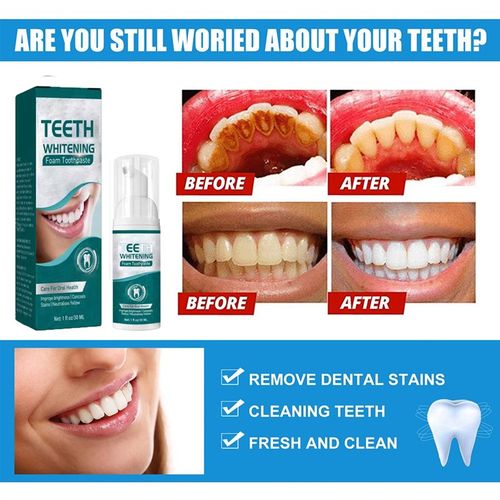 极速Teeth Whitening Mousse Dental Care Essence RemovXe Plaqu