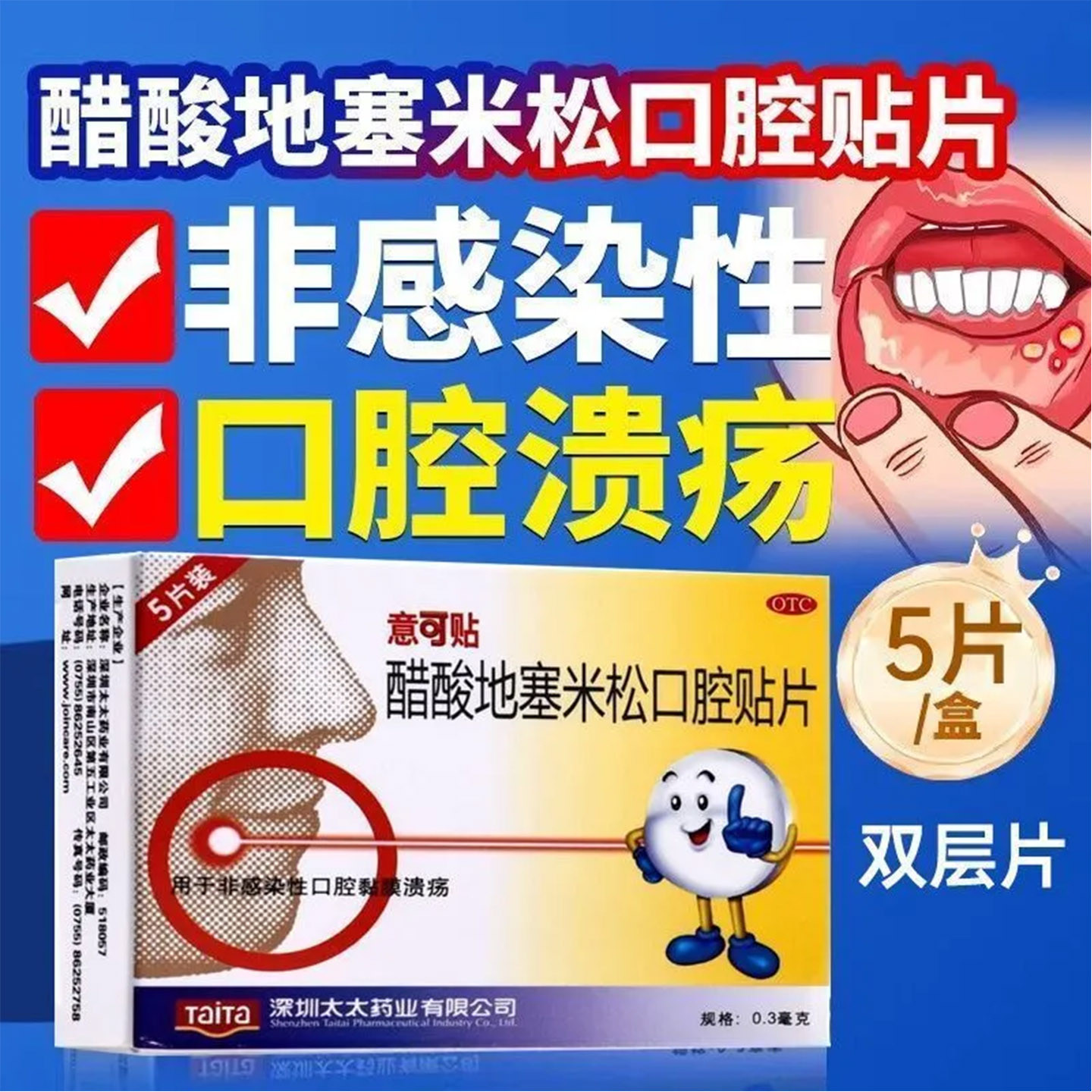 意可贴 醋酸地塞米松口腔贴片5片口腔溃疡贴片口疮疼痛消炎药药贴