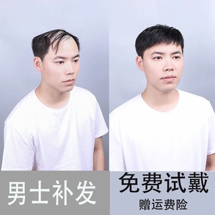 极速男士补发片假发男式r头顶补发前额秃顶补发垫接翻盖假发真发