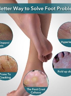 极速1pcs Double Side Foot File Professional Rasp UHeel Grate