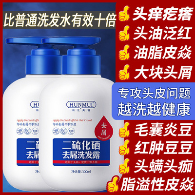 二硫化硒去屑洗发水洗头水头皮护理清洁控油止痒蓬松官方旗舰正品