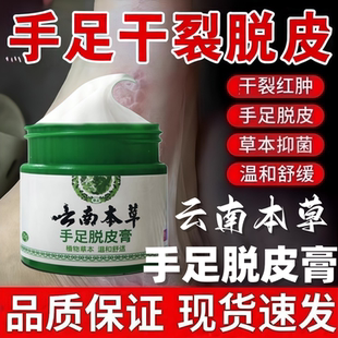 手足脱皮膏抑菌膏呵护手指上干燥起皮儿童手掌蜕皮手脚掉皮皴裂膏