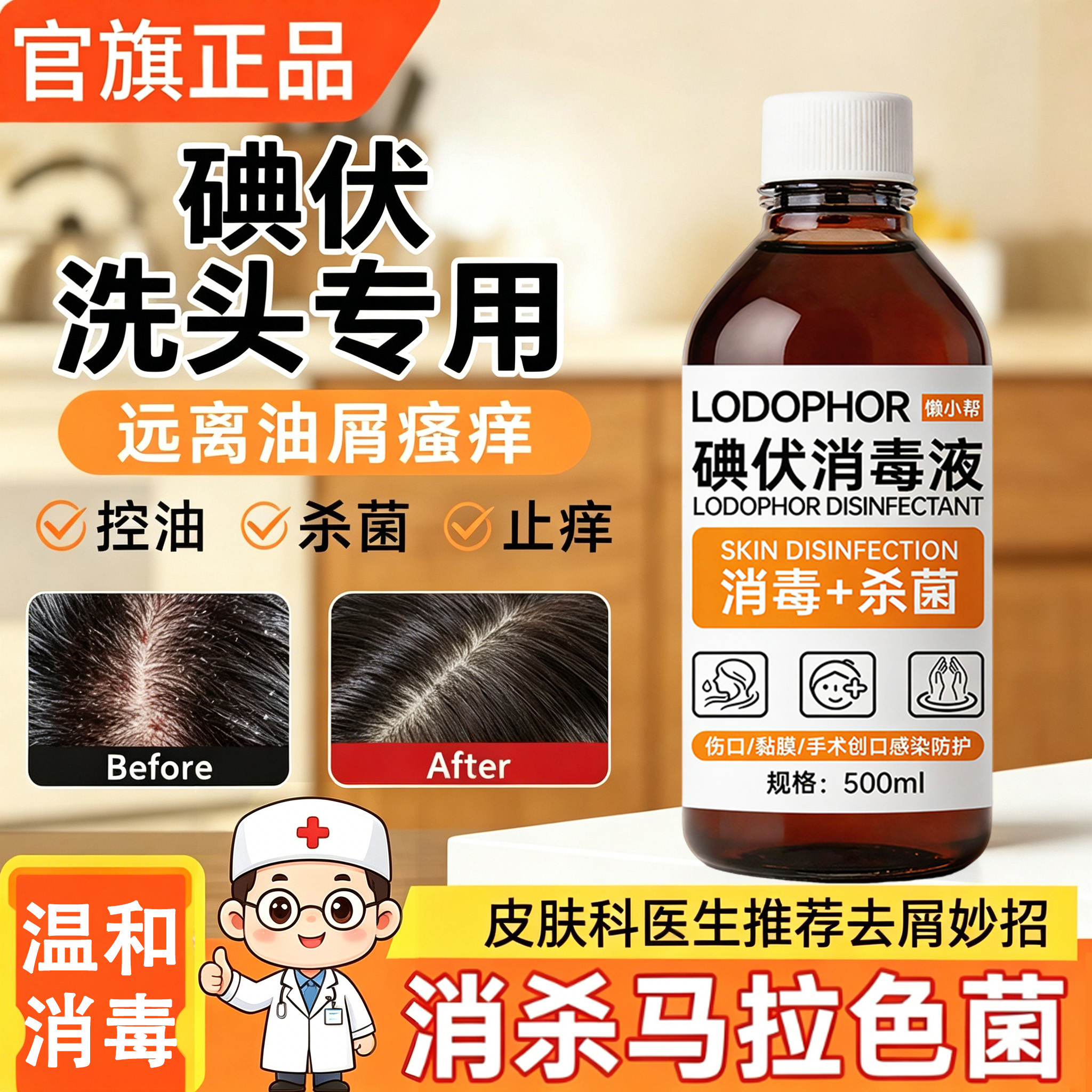 碘伏消毒液洗发水洗头发专用控油止痒去头屑痘痘除螨杀菌消毒液￥