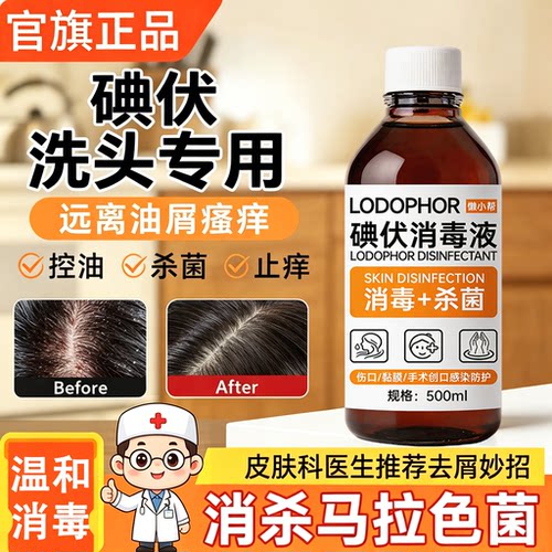 碘伏洗头消毒液控油除螨杀菌