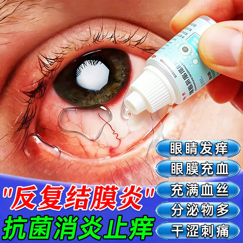 治疗结膜炎的眼药水止痒消炎杀菌眼睛干涩发痒眼痒药沙眼滴眼液